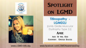 lgmd2j-amie