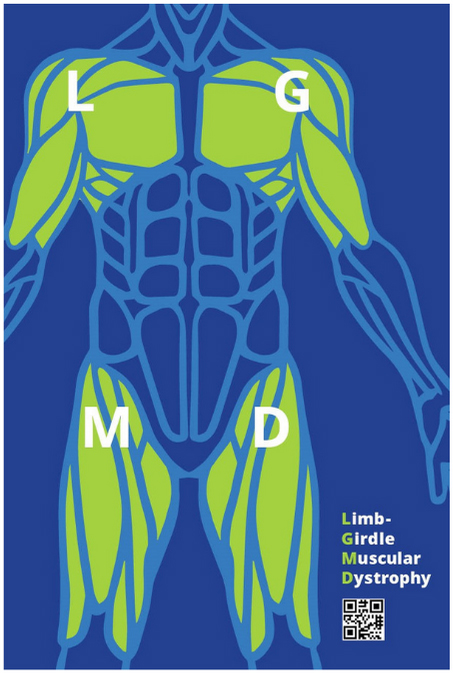 Lgmd Body